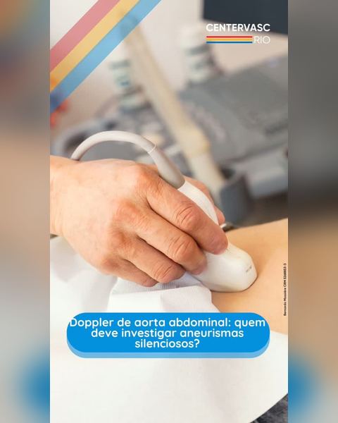 O aneurisma de aorta abdominal costuma evoluir sem sintomas e, muitas…