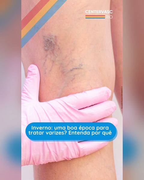 Sim! O inverno costuma ser uma das épocas mais indicadas para iniciar…